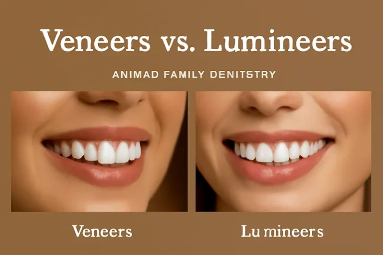 Veneers vs. Lumineers