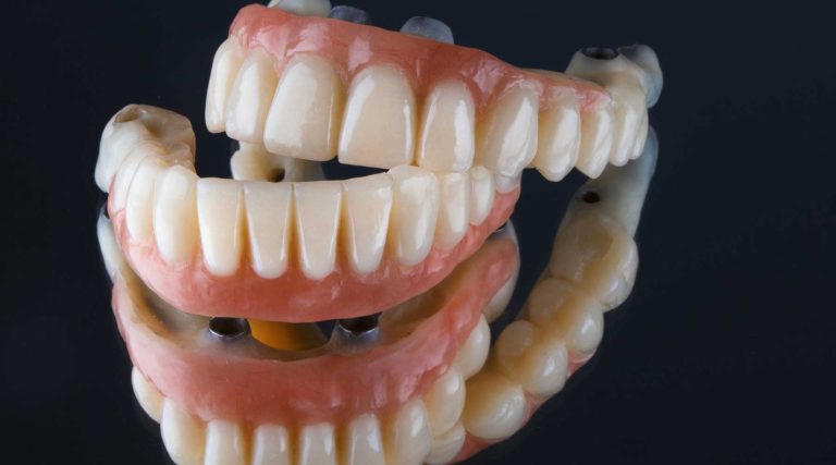 Full Mouth Restoration
